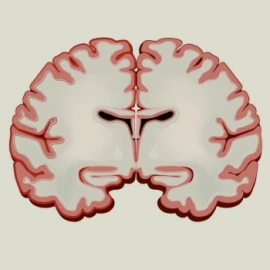 epilepsy children-86418c5b85c52ca977a51ea485245e69.jpg